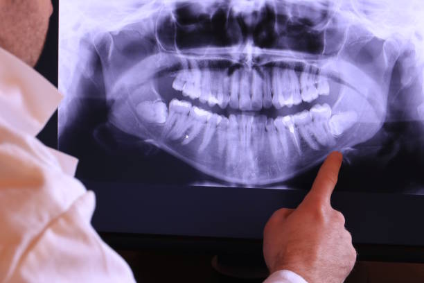 Best Emergency Broken Tooth Repair in East Dublin, GA