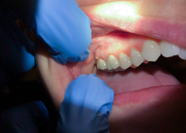 Best Urgent Dental Care in East Dublin, GA