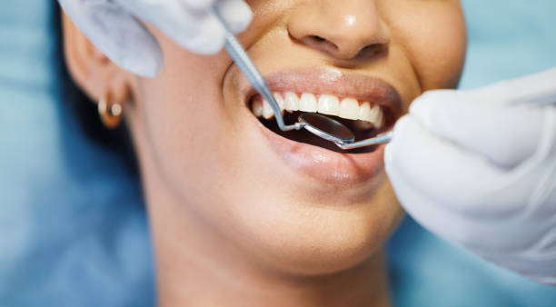 Best Emergency Wisdom Teeth Removal in East Dublin, GA